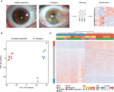 Characterization of the Cellular Microenvironment and Novel Specific Biomarkers in Pterygia Using RNA Sequencing